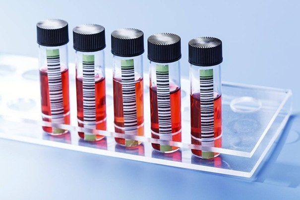 生物制品進口清關代理需要多長時間 生物制品進口清關代理需要多長時間