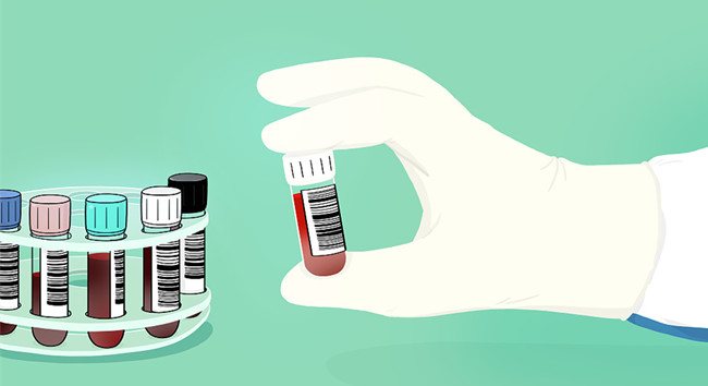 進口胎牛血清關需要什么資質? 進口胎牛血清關需要什么資質?